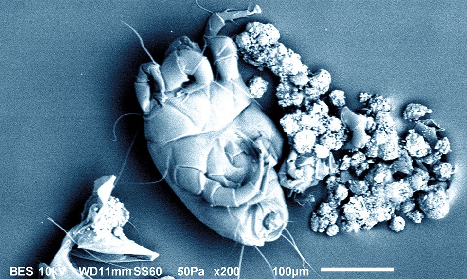 Matratze Hausstaubmilben