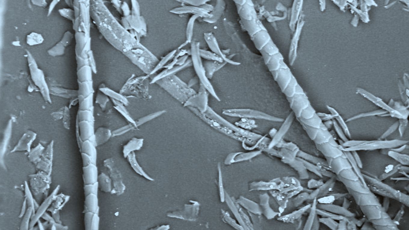 Partikel unter Mikroskop 