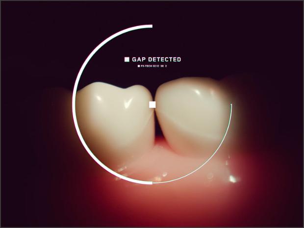 Representation of how Dyson’s Gap Optical Targeting detects gaps between teeth.