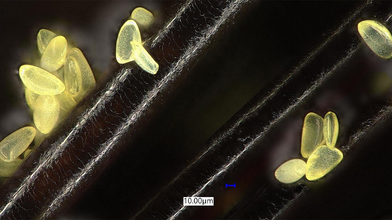Pollen particles stuck to a strand of hair, seen under a microscope