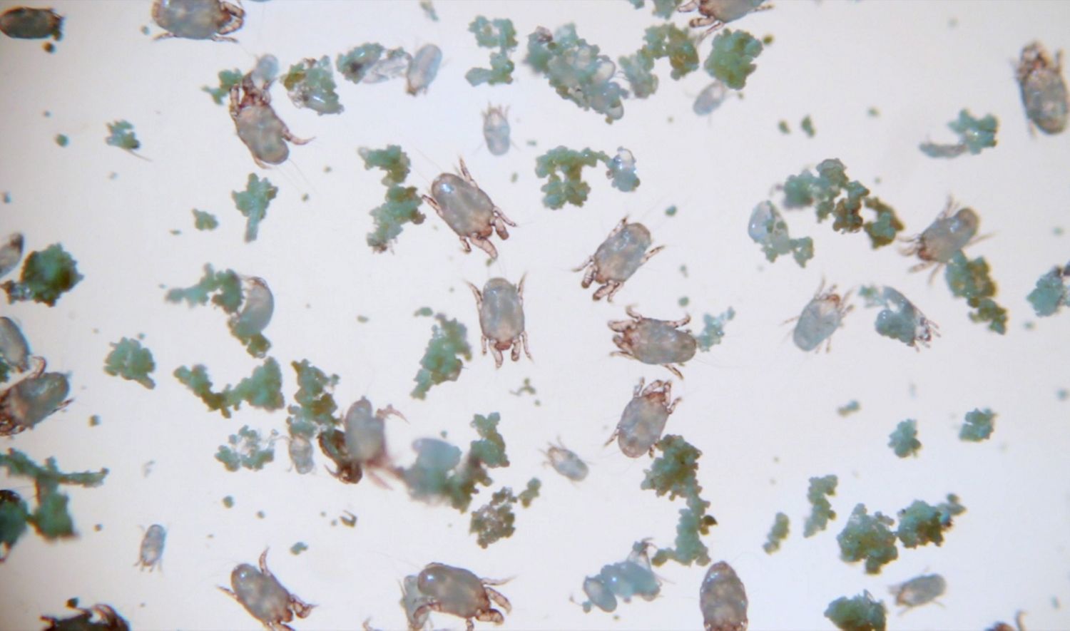  Primo piano di acari della polvere al microscopio