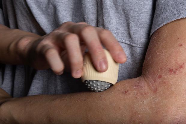 Rollerball Itch Relief