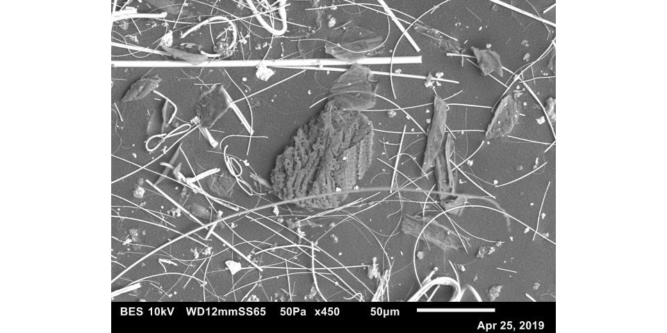 Dust particle.