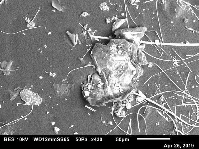 Skin flake particle.