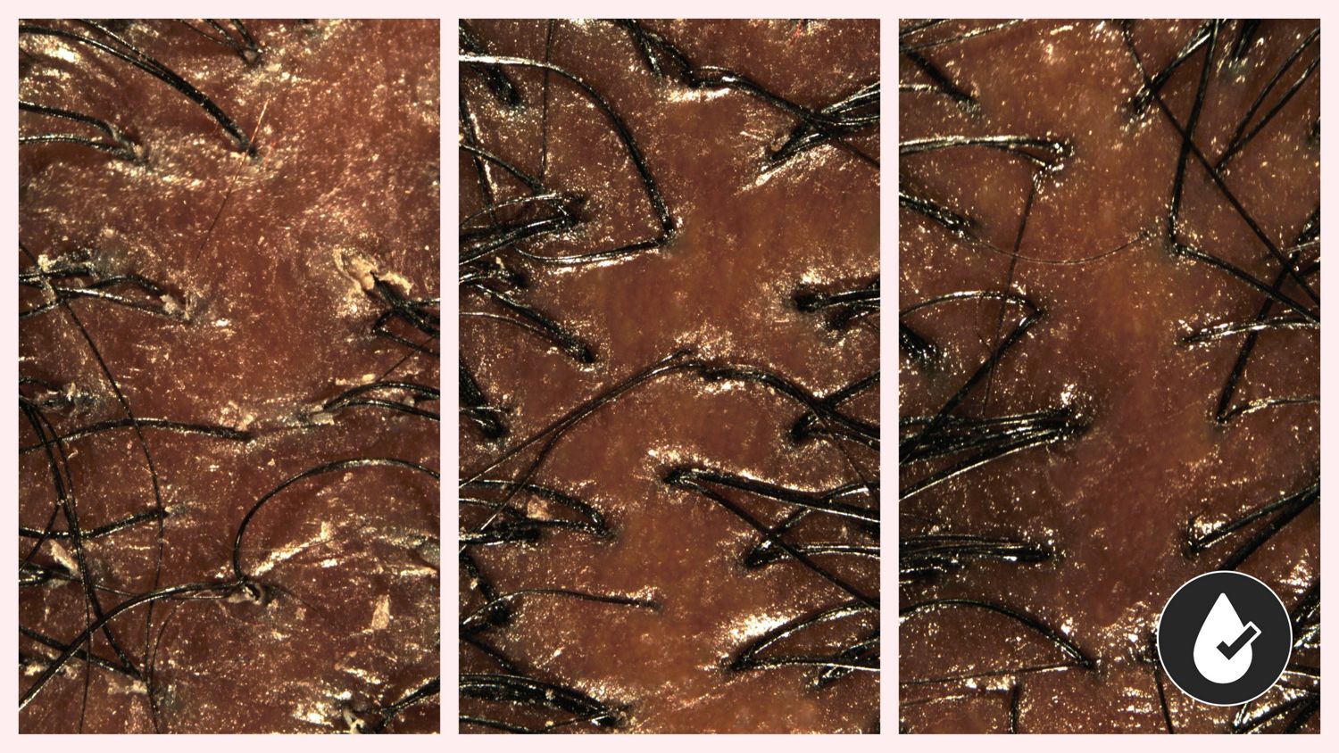 Before, during and after imagery of Dyson Amino leave-in scalp bubble treatment used on a scalp.