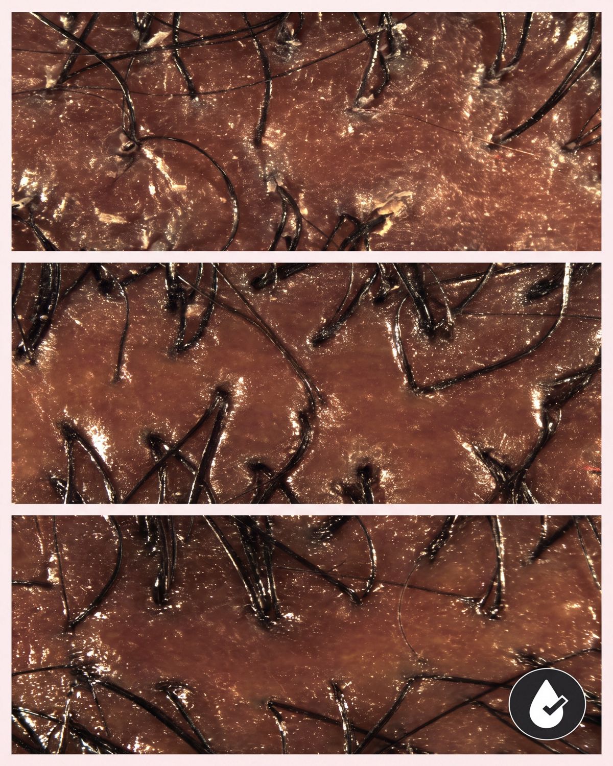 Before, during and after imagery of Dyson Amino leave-in scalp bubble treatment used on a scalp.