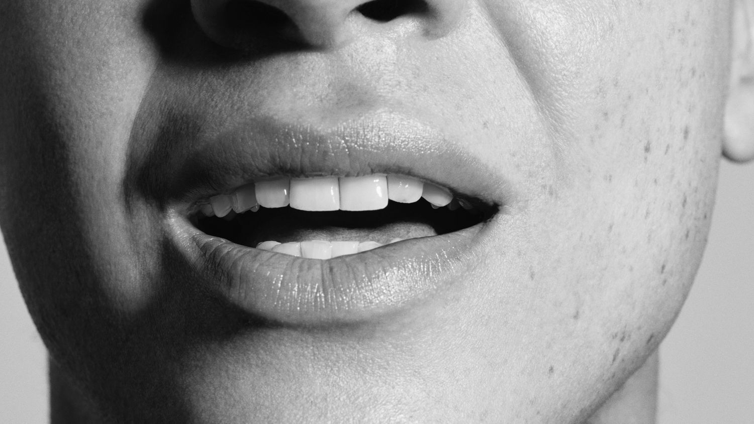 A smile reveals pristine white teeth.