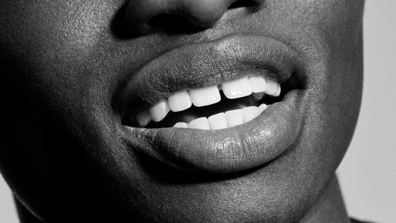 A smile reveals pristine white teeth.