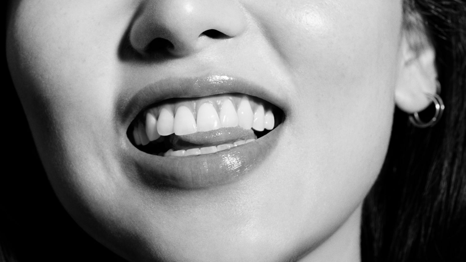 A smile reveals white teeth and healthy gums.