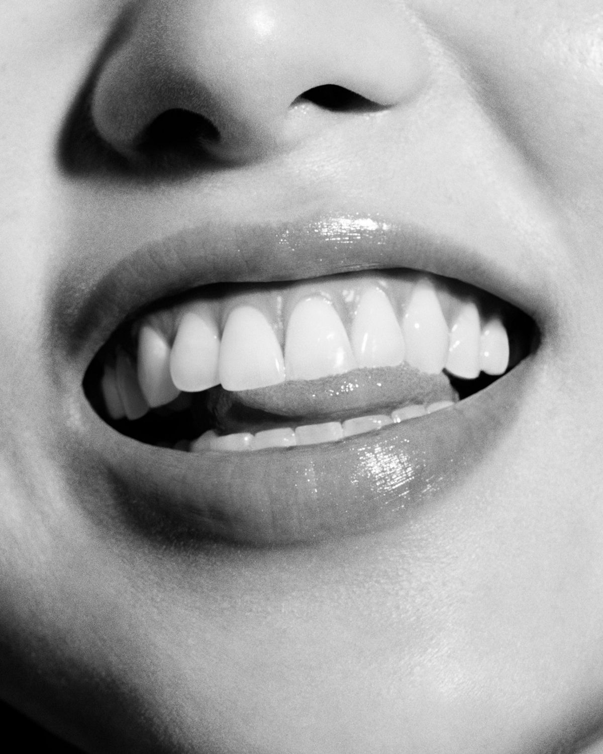 A smile reveals white teeth and healthy gums.