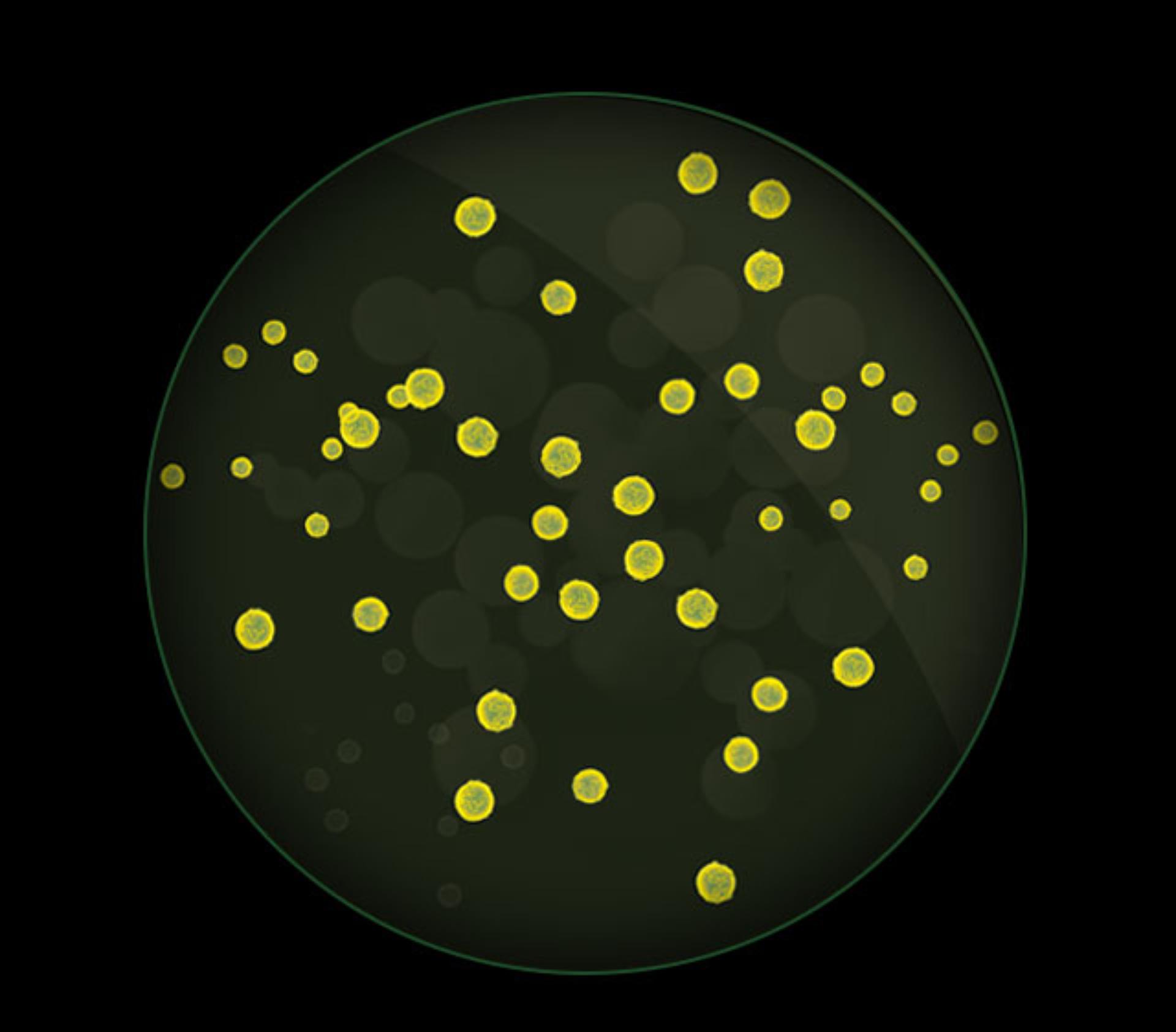 포름알데히드를 포함한 유해 물질과 가스를 특수 현미경으로 확대한 모습