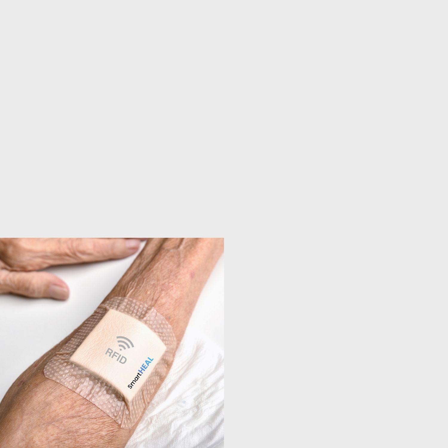 A photo of SmartHEAL's smart bandage on the arm of a patient.
