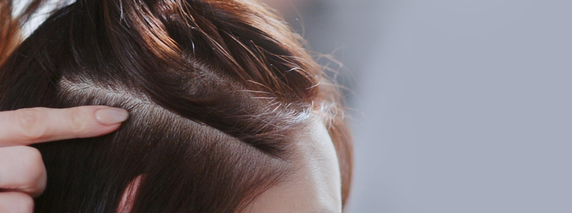 A close animation of the scalp barrier