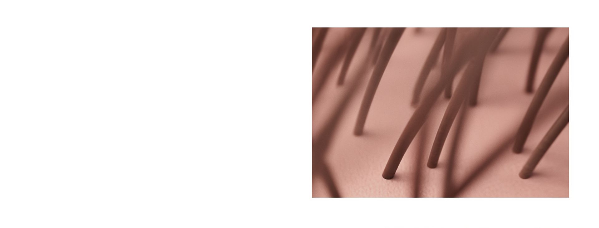 Close up of hair strands growing from the scalp barrier