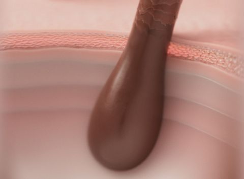 Close up of a scalp