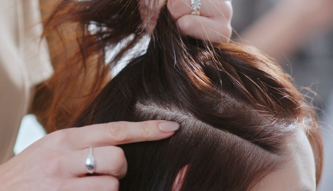 髪を分けた女性の頭皮のクローズアップ