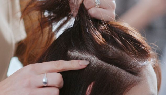 髪を分けた女性の頭皮のクローズアップ