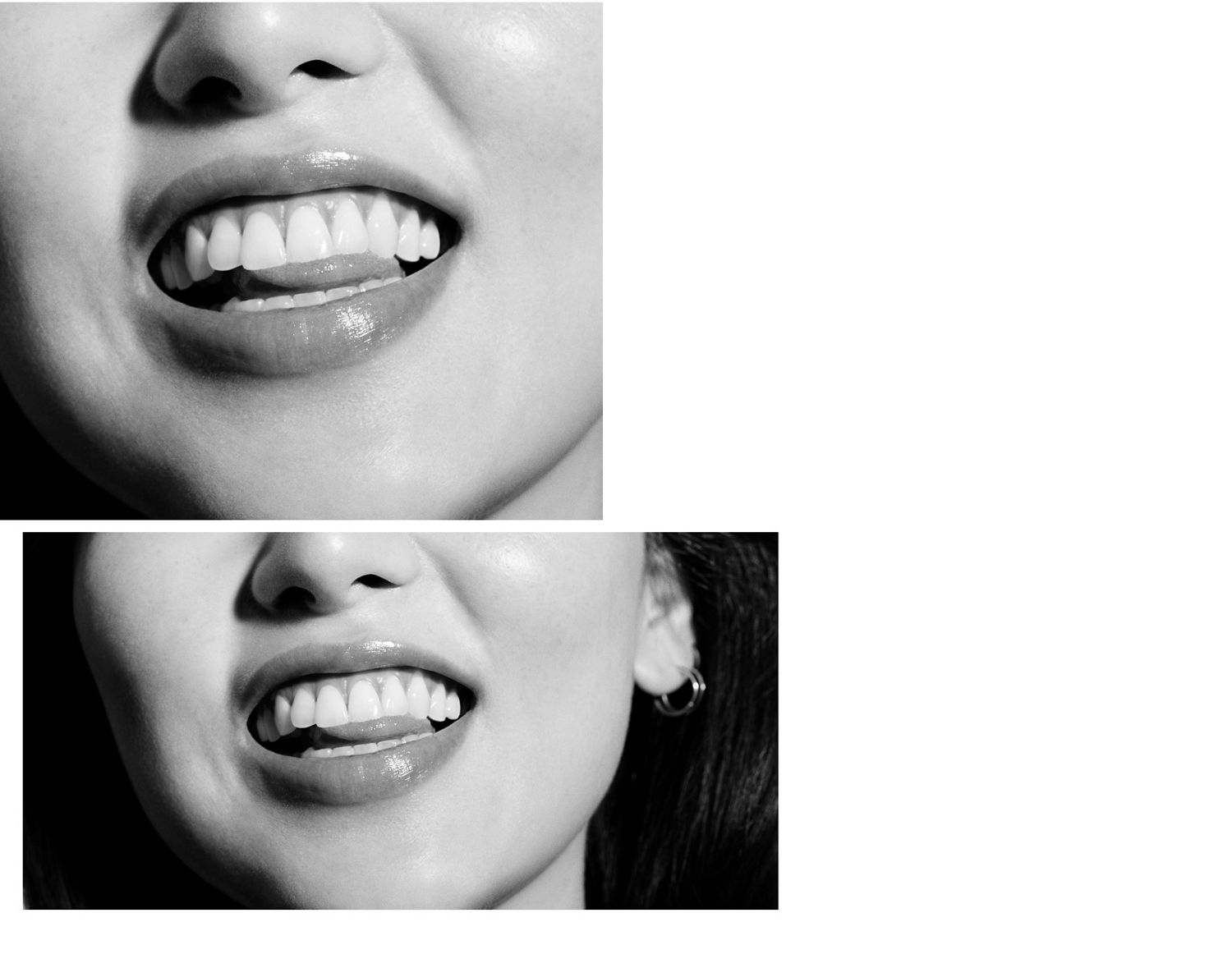 A smiling face showing healthy gums and teeth.