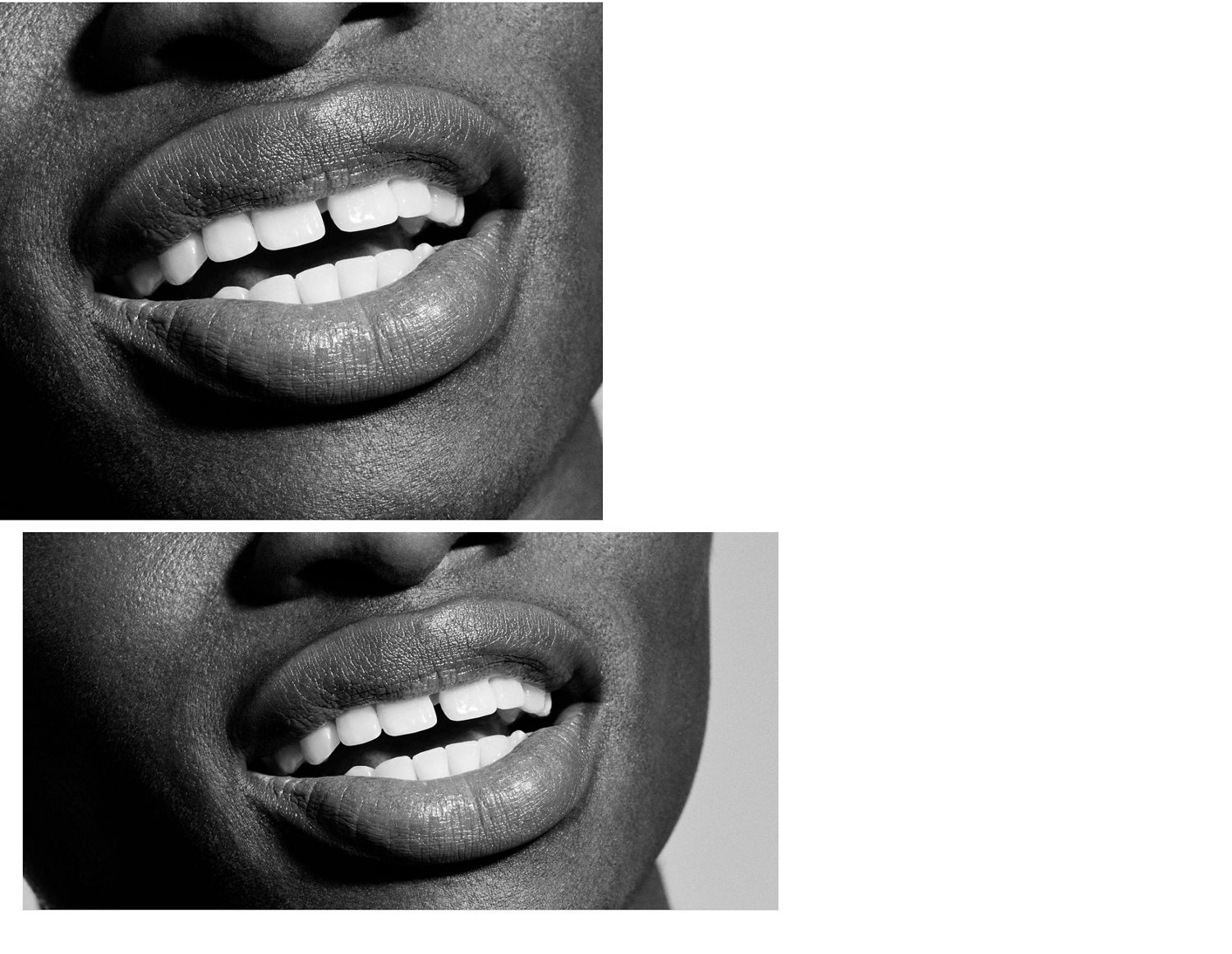 A smiling face showing white teeth.