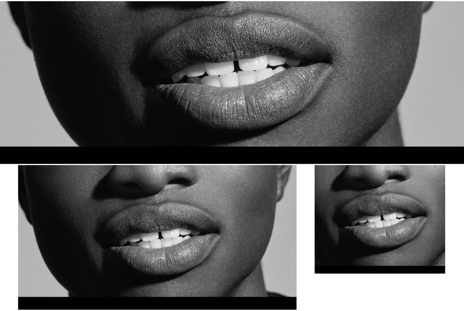 Close up of a smile showing healthy, white teeth.