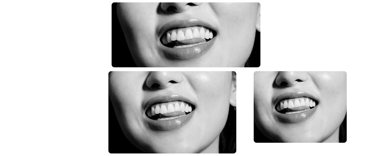A smile showing healthy teeth.