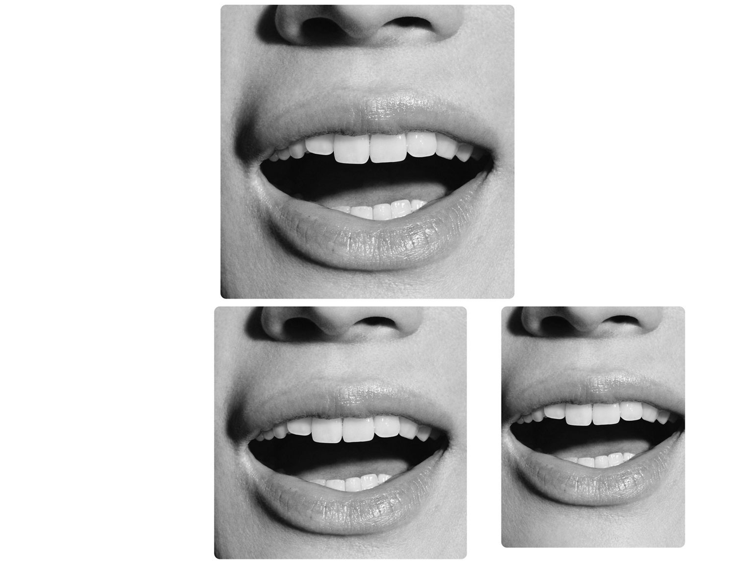 A wide smile showing healthy teeth.