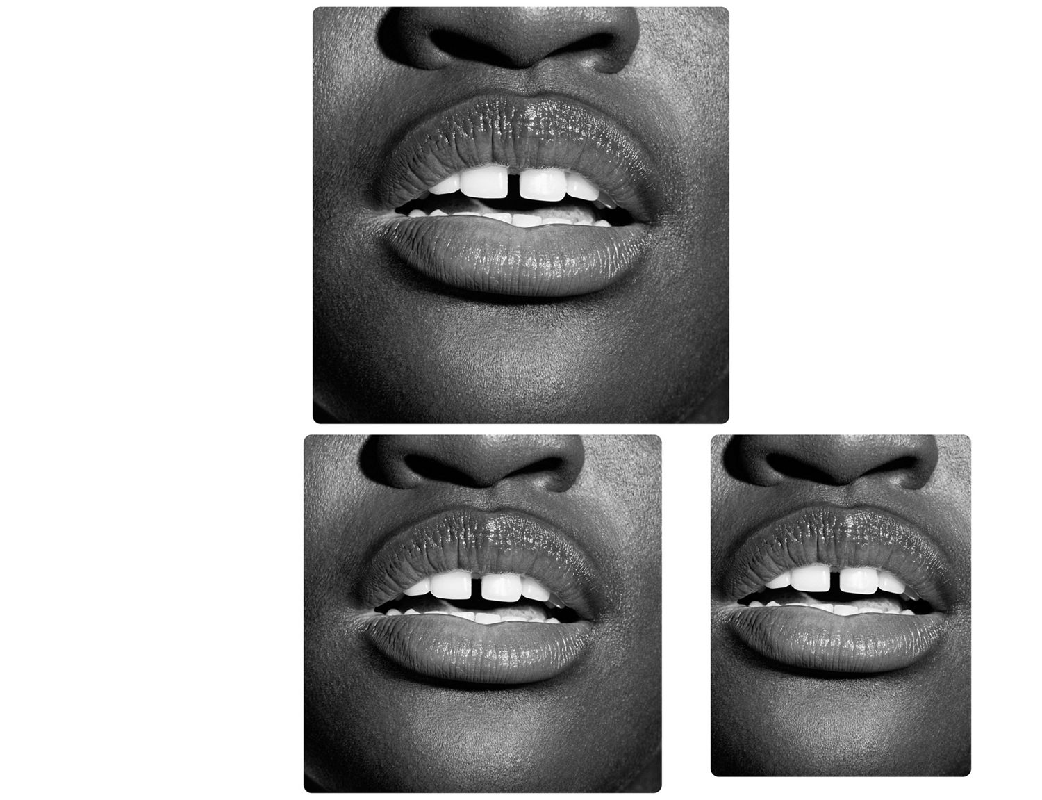 A smile showing white teeth.
