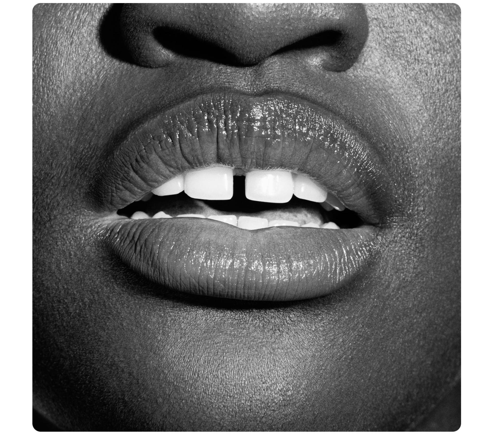 A smile showing white teeth.