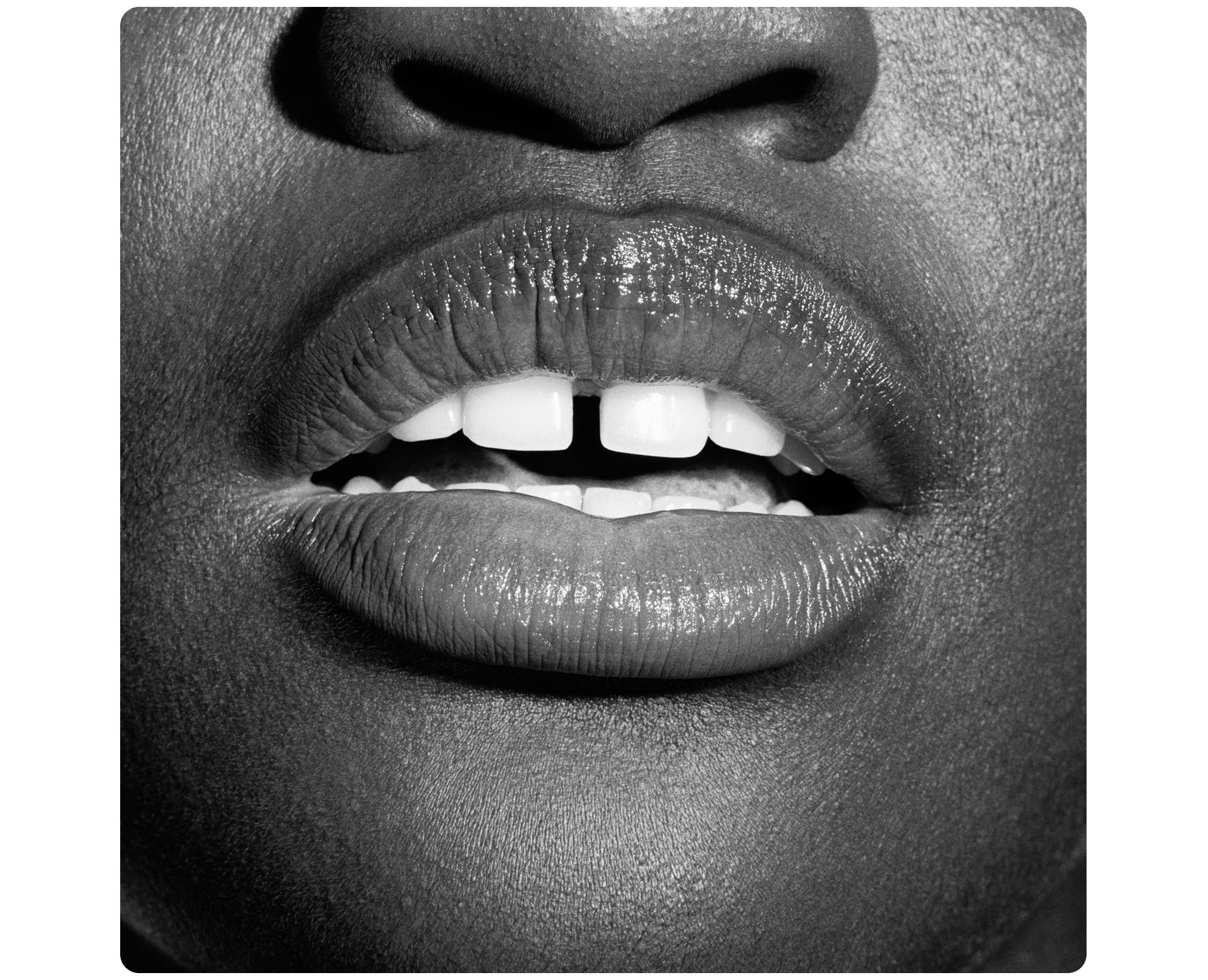 A smile showing white teeth.
