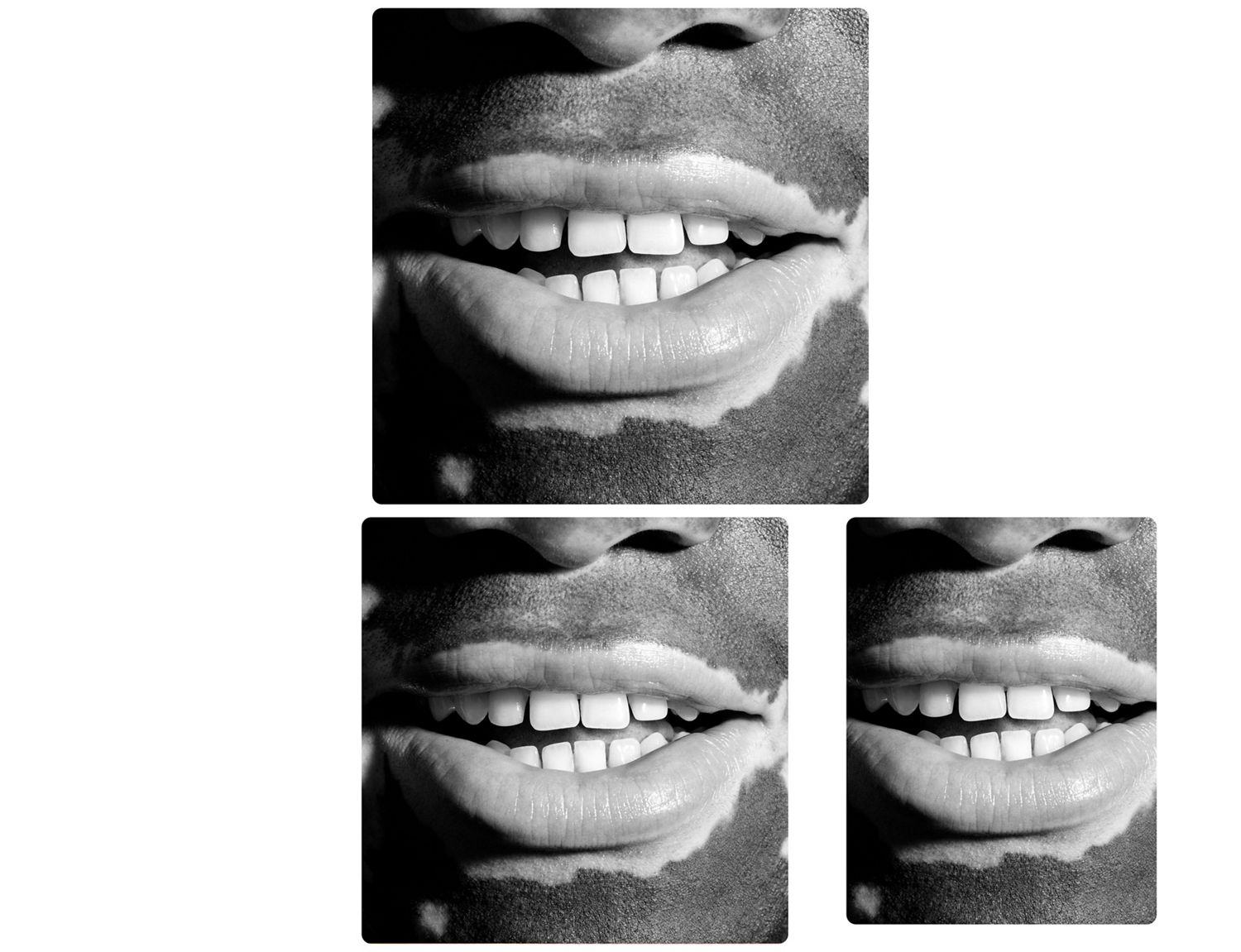 A wide smile showing healthy teeth.