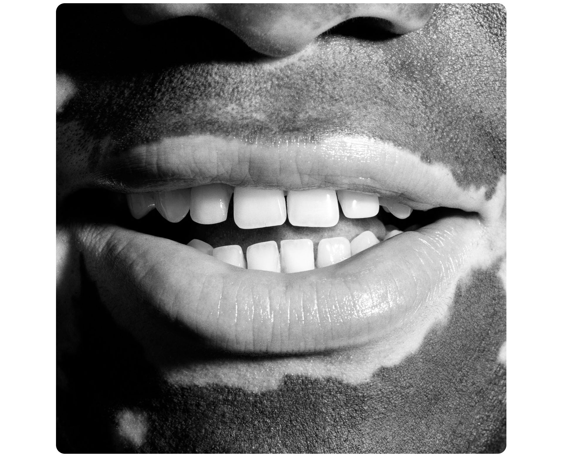 A wide smile showing healthy teeth.