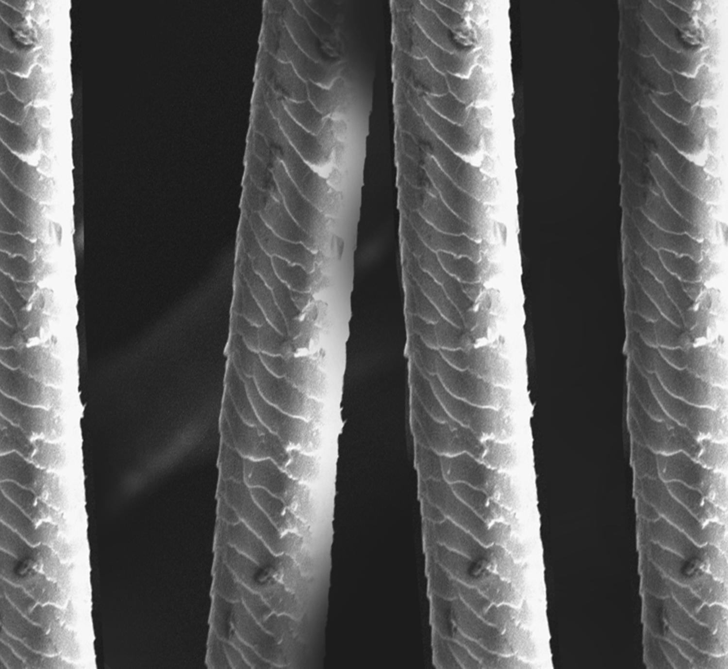 Seasonal allergy relief, treatments, and tips