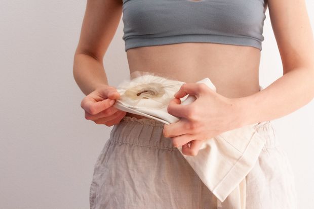 Projekt os-tomy z Austrii